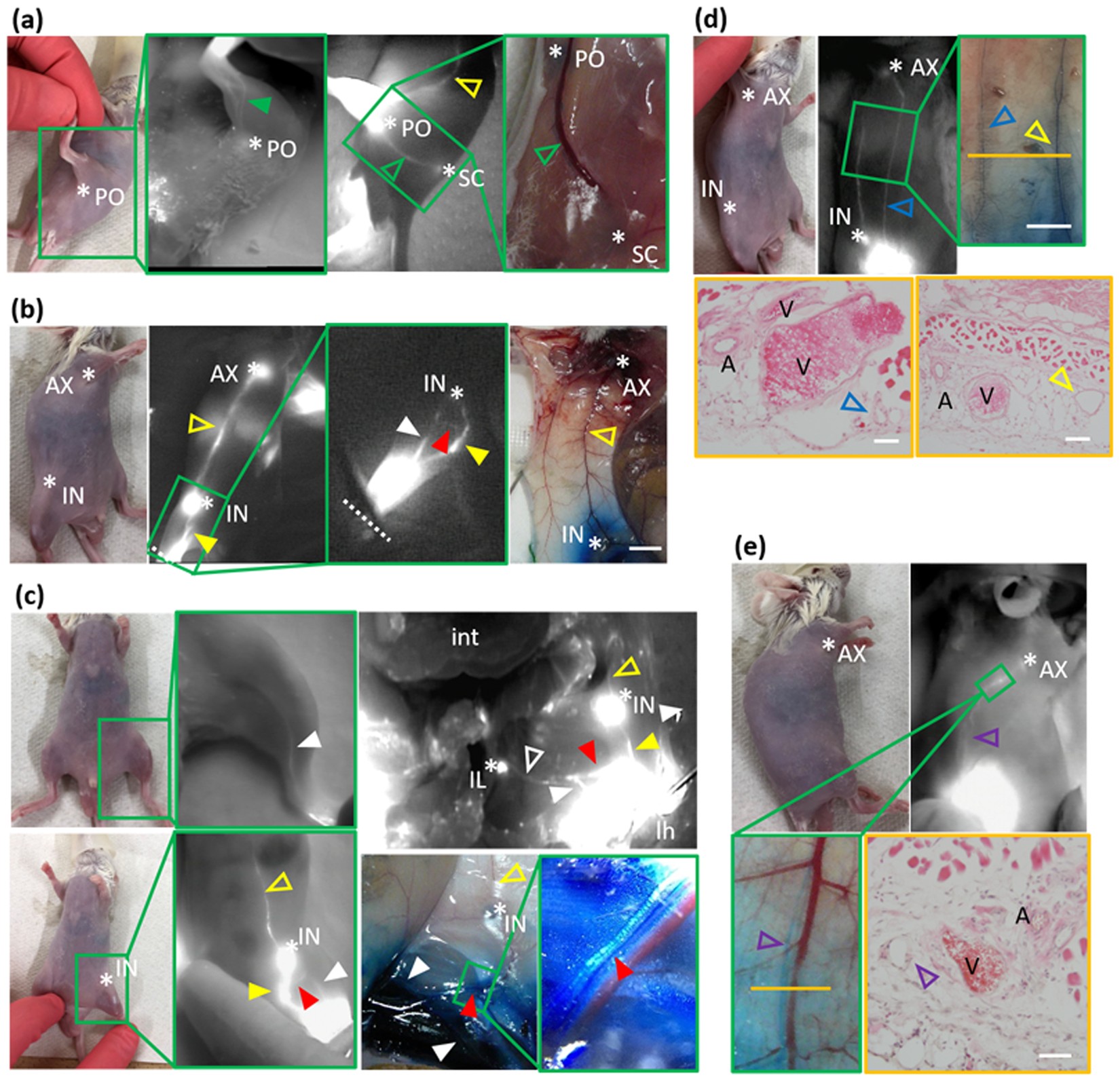 Near-infrared fluorescence imaging of lymphatic drainage