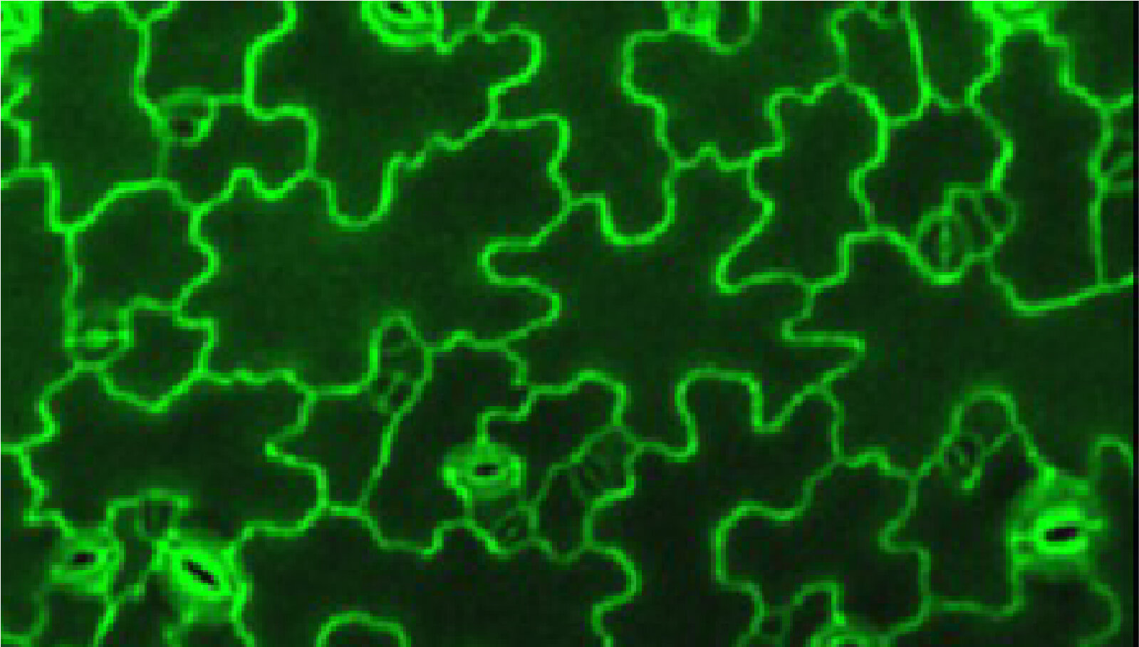 Lymphatic vessel endothelial cell morphology