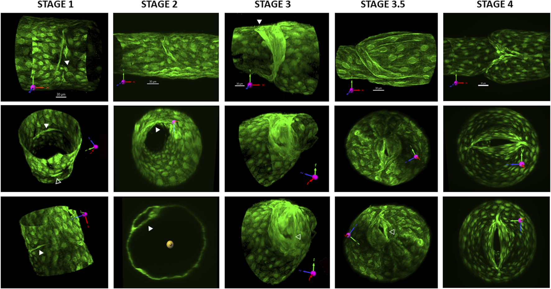 Developmental progression of lymphatic valve morphology